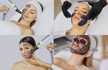 What is a Carbon Laser Facial?