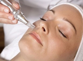 Nano-needling