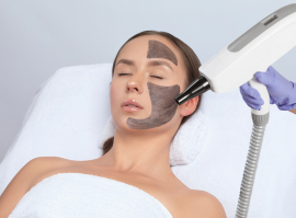 Carbon Laser Facial