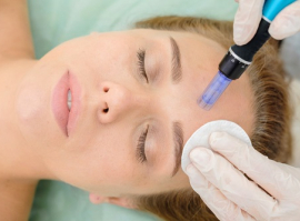 Micro-needling