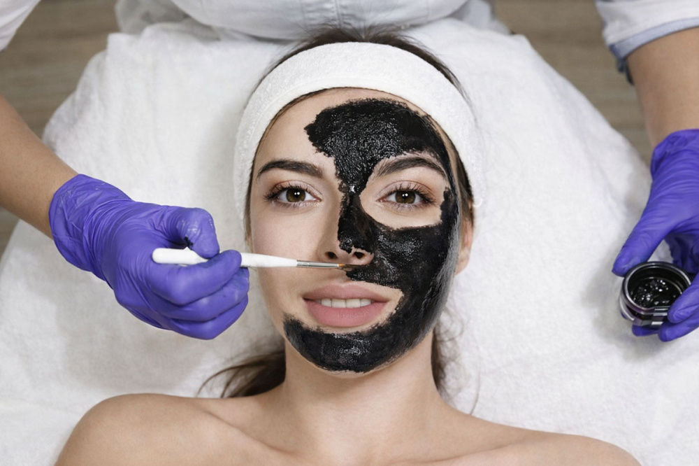 What Is a Hollywood Carbon Peel Treatment for Skin